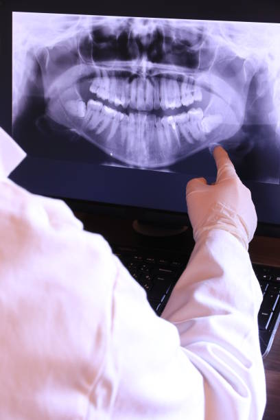 Best Emergency Tooth Extraction in Shaw Heights, CO